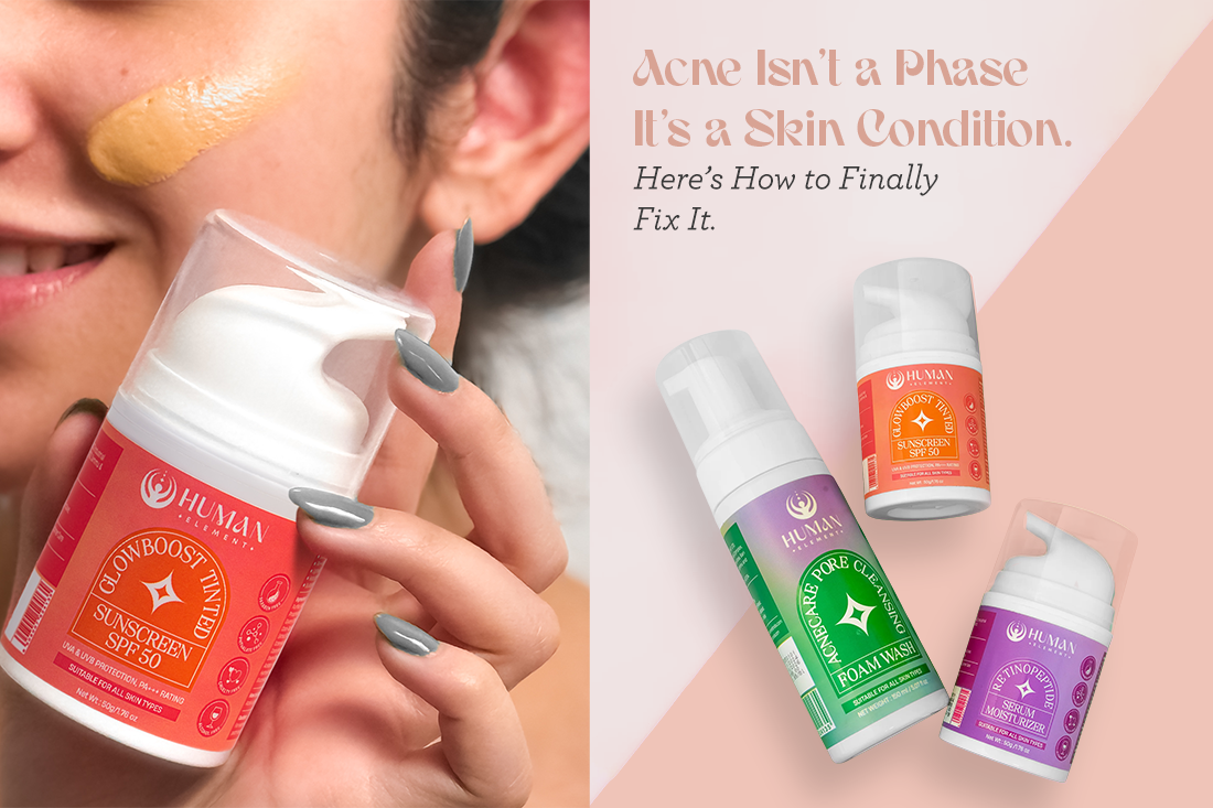 How to Cure Acne with Human Element’s Proven Skincare Routine